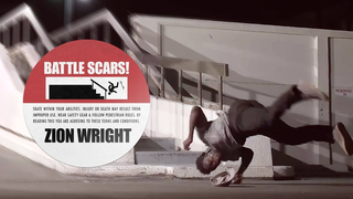 Zion Wright's Battle Scars: Reliving the worst injuries of his career