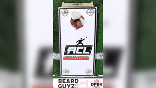 What would you have done in this situation? #cornholetiktok #cornho...