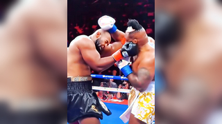 Big Baby Miller Keeps His Cool After Viral Hairpiece Moment