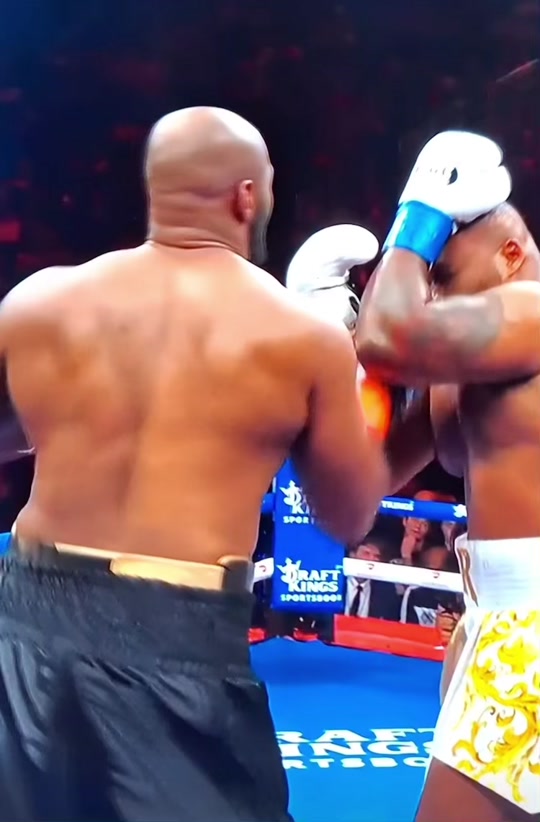 Big Baby Miller Keeps His Cool After Viral Hairpiece Moment